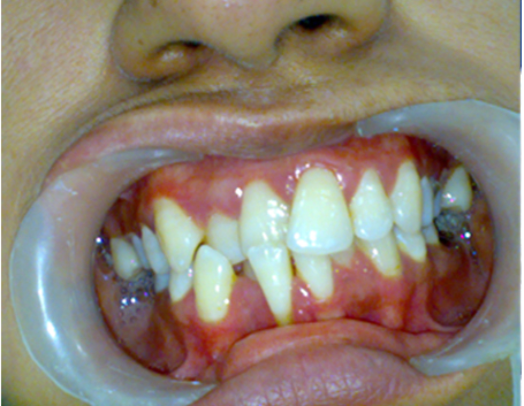 Before Treatment 2